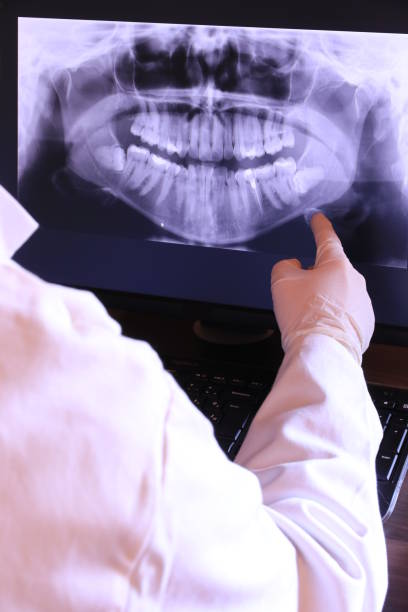 Best Emergency Dental Extractions in Romeovle, IL