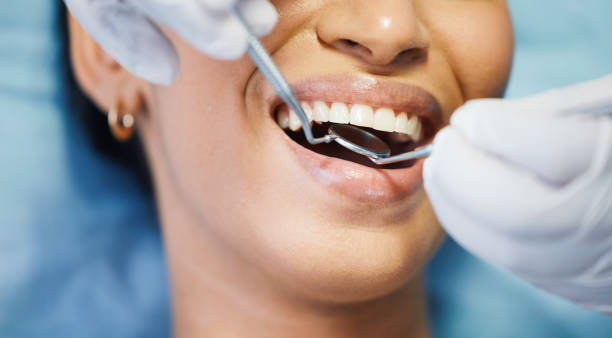 Best Emergency Dental Extractions in Romeovle, IL