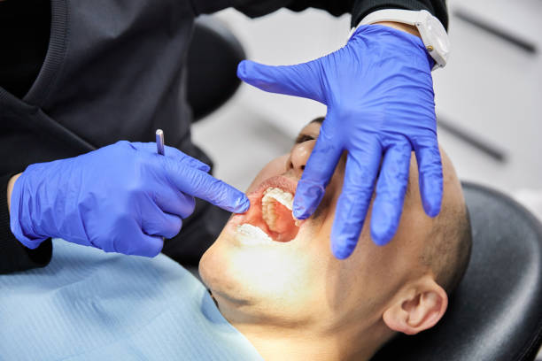 Best Emergency Dental Extractions in Romeovle, IL